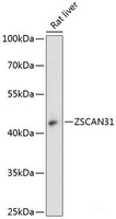 Western blot analysis of extracts of Rat liver using ZSCAN31 Polyclonal Antibody at dilution of 1:3000.