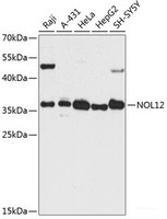 Western blot analysis of extracts of various cell lines using NOL12 Polyclonal Antibody at dilution of 1:3000.