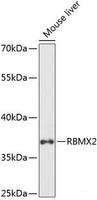 Western blot analysis of extracts of Mouse liver using RBMX2 Polyclonal Antibody at dilution of 1:1000.