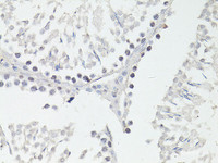 Immunohistochemistry of paraffin-embedded Rat testis using FTO Polyclonal Antibody at dilution of 1:100 (40x lens) .