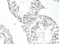 Immunohistochemistry of paraffin-embedded Mouse testis using FTO Polyclonal Antibody at dilution of 1:100 (40x lens) .
