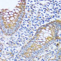 Immunohistochemistry of paraffin-embedded Human appendix using ACOT2 Polyclonal Antibody at dilution of 1:100 (40x lens) .