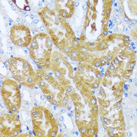 Immunohistochemistry of paraffin-embedded Mouse kidney using ACOT2 Polyclonal Antibody at dilution of 1:100 (40x lens) .