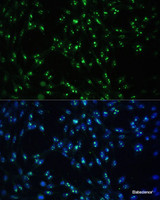 Immunofluorescence analysis of NIH-3T3 cells using CCDC59 Polyclonal Antibody at dilution of 1:100. Blue: DAPI for nuclear staining.