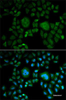 Immunofluorescence analysis of HeLa cells using CA2 Polyclonal Antibody