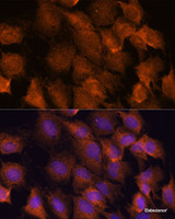 Immunofluorescence analysis of C6 cells using SCRN3 Polyclonal Antibody at dilution of 1:100. Blue: DAPI for nuclear staining.