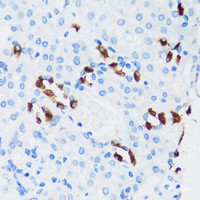 Immunohistochemistry of paraffin-embedded Mouse kidney using ATP6V1G3 Polyclonal Antibody at dilution of 1:100 (40x lens) .