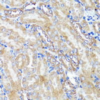 Immunohistochemistry of paraffin-embedded Mouse kidney using CNR1 Polyclonal Antibody at dilution of 1:150 (40x lens) .