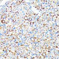 Immunohistochemistry of paraffin-embedded Rat ovary using CNR1 Polyclonal Antibody at dilution of 1:150 (40x lens) .