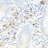 Immunohistochemistry of paraffin-embedded Human appendix using TPSAB1 Polyclonal Antibody at dilution of 1:100 (40x lens) .