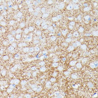 Immunohistochemistry of paraffin-embedded Mouse brain using SNCG Polyclonal Antibody at dilution of 1:100 (40x lens) .