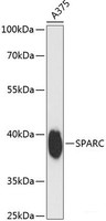 Western blot analysis of extracts of A375 cells using SPARC Polyclonal Antibody at dilution of 1:3000.