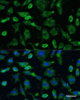 Immunofluorescence analysis of L-929 cells using SPARC Polyclonal Antibody at dilution of 1:100 (40x lens) . Blue: DAPI for nuclear staining.