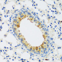 Immunohistochemistry of paraffin-embedded Mouse lung using CAMK1 Polyclonal Antibody at dilution of 1:100 (40x lens) .