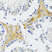 Immunohistochemistry of paraffin-embedded Mouse testis using CAMK1 Polyclonal Antibody at dilution of 1:100 (40x lens) .