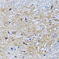 Immunohistochemistry of paraffin-embedded Mouse spinal cord using CAMK1 Polyclonal Antibody at dilution of 1:100 (40x lens) .