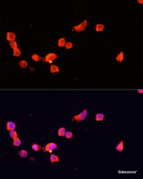 Immunofluorescence analysis of SH-SY5Y cells using CDK5R1 Polyclonal Antibody at dilution of 1:100. Blue: DAPI for nuclear staining.