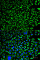 Immunofluorescence analysis of A549 cells using F10 Polyclonal Antibody