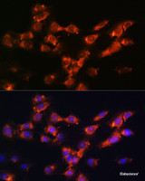 Immunofluorescence analysis of C6 cells using DPP4 Polyclonal Antibody at dilution of 1:100. Blue: DAPI for nuclear staining.