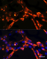 Immunofluorescence analysis of NIH/3T3 cells using DPP4 Polyclonal Antibody at dilution of 1:100. Blue: DAPI for nuclear staining.