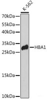 Western blot analysis of extracts of K-562 cells using HBA1 Polyclonal Antibody at dilution of 1:3000.