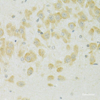 Immunohistochemistry of paraffin-embedded Rat brain using SLC37A4 Polyclonal Antibody at dilution of 1:100 (40x lens) .