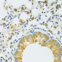 Immunohistochemistry of paraffin-embedded Mouse lung using SLC37A4 Polyclonal Antibody at dilution of 1:100 (40x lens) .