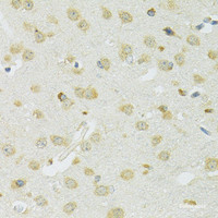 Immunohistochemistry of paraffin-embedded Mouse brain using SLC37A4 Polyclonal Antibody at dilution of 1:100 (40x lens) .