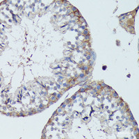 Immunohistochemistry of paraffin-embedded Mouse testis using SLC7A2 Polyclonal Antibody at dilution of 1:100 (40x lens) .