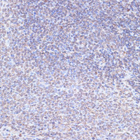 Immunohistochemistry of paraffin-embedded Rat spleen using SNW1 Polyclonal Antibody at dilution of 1:100 (40x lens) .