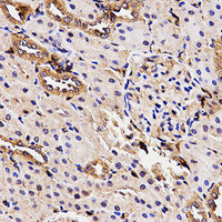 Immunohistochemistry of paraffin-embedded Rat kidney using BCHE Polyclonal Antibody at dilution of 1:100 (40x lens) .
