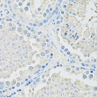 Immunohistochemistry of paraffin-embedded Mouse testis using SLC2A9 Polyclonal Antibody at dilution of 1:100 (40x lens) .