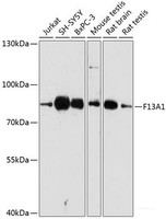 Western blot analysis of extracts of various cell lines using F13A1 Polyclonal Antibody at dilution of 1:3000.