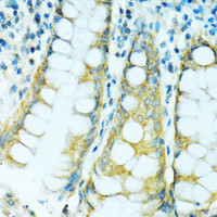 Immunohistochemistry of paraffin-embedded Human colon using CYP2B6 Polyclonal Antibody at dilution of 1:100 (40x lens) .