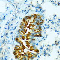 Immunohistochemistry of paraffin-embedded Mouse lung using CYP2B6 Polyclonal Antibody at dilution of 1:100 (40x lens) .