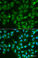 Immunofluorescence analysis of MCF-7 cells using LGALS3 Polyclonal Antibody