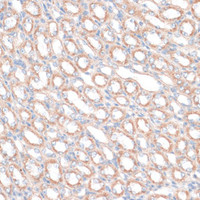 Immunohistochemistry of paraffin-embedded Mouse kidney using PDGFD Polyclonal Antibody at dilution of 1:100 (40x lens) .