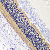 Immunohistochemistry of paraffin-embedded Rat retina using PDC Polyclonal Antibody at dilution of 1:200 (40x lens) .