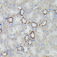 Immunohistochemistry of paraffin-embedded Rat kidney using NDUFAB1 Polyclonal Antibody at dilution of 1:100 (40x lens) .