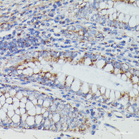 Immunohistochemistry of paraffin-embedded Human colon using NDUFAB1 Polyclonal Antibody at dilution of 1:100 (40x lens) .