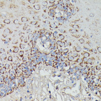 Immunohistochemistry of paraffin-embedded Human esophageal using NDUFAB1 Polyclonal Antibody at dilution of 1:100 (40x lens) .
