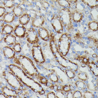Immunohistochemistry of paraffin-embedded Mouse kidney using NDUFAB1 Polyclonal Antibody at dilution of 1:100 (40x lens) .