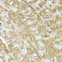 Immunohistochemistry of paraffin-embedded Rat heart using COX15 Polyclonal Antibody at dilution of 1:100 (40x lens) .