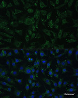 Immunofluorescence analysis of L929 cells using APH1A Polyclonal Antibody at dilution of 1:100 (40x lens) . Blue: DAPI for nuclear staining.