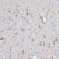 Immunohistochemistry of paraffin-embedded Rat brain using GFAP Polyclonal Antibody at dilution of 1:200 (40x lens) .