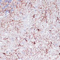 Immunohistochemistry of paraffin-embedded Rat cerebellum using GFAP Polyclonal Antibody at dilution of 1:100 (40x lens) .