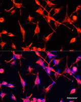 Immunofluorescence analysis of U-251MG cells using GFAP Polyclonal Antibody at dilution of 1:100. Blue: DAPI for nuclear staining.