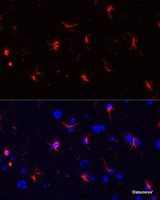 Immunofluorescence analysis of Rat brain using GFAP Polyclonal Antibody at dilution of 1:100. Blue: DAPI for nuclear staining.