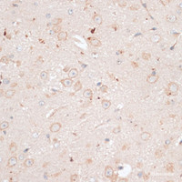 Immunohistochemistry of paraffin-embedded Mouse brain using ABCB7 Polyclonal Antibody at dilution of 1:100 (40x lens) .