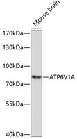 Western blot analysis of extracts of Mouse brain using ATP6V1A Polyclonal Antibody at dilution of 1:1000.